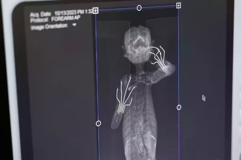 Radiografía de la momia sirena.